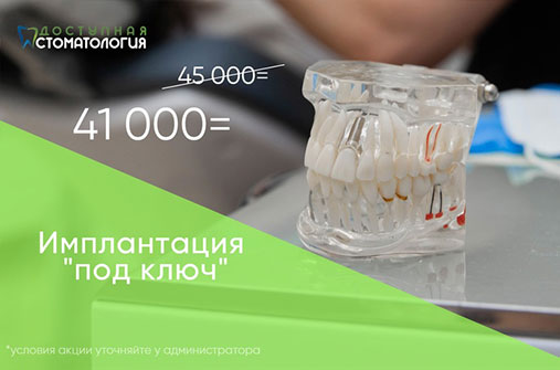 Имплантация под ключ за 41000 руб.