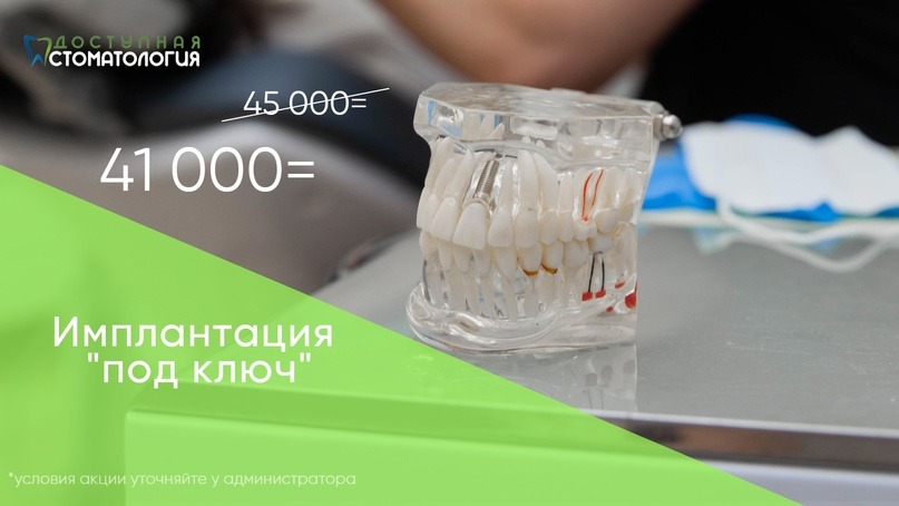 Доступная стоматология новосибирск богдана хмельницкого 15 фото