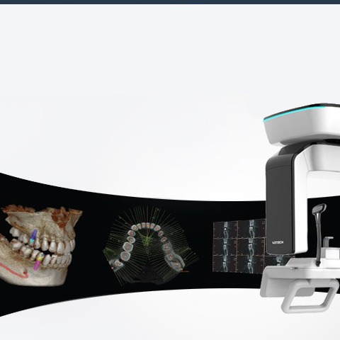 Лечение КТ челюсти (Компьютерная томография зубов)