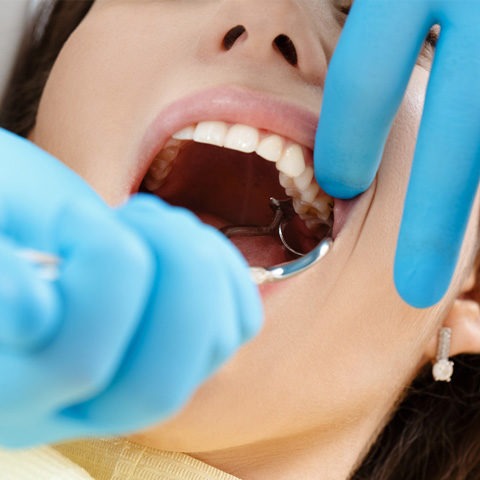 Удаление зуба в Доступной Стоматологии
