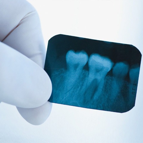 Рентген зубов в Новосибирске