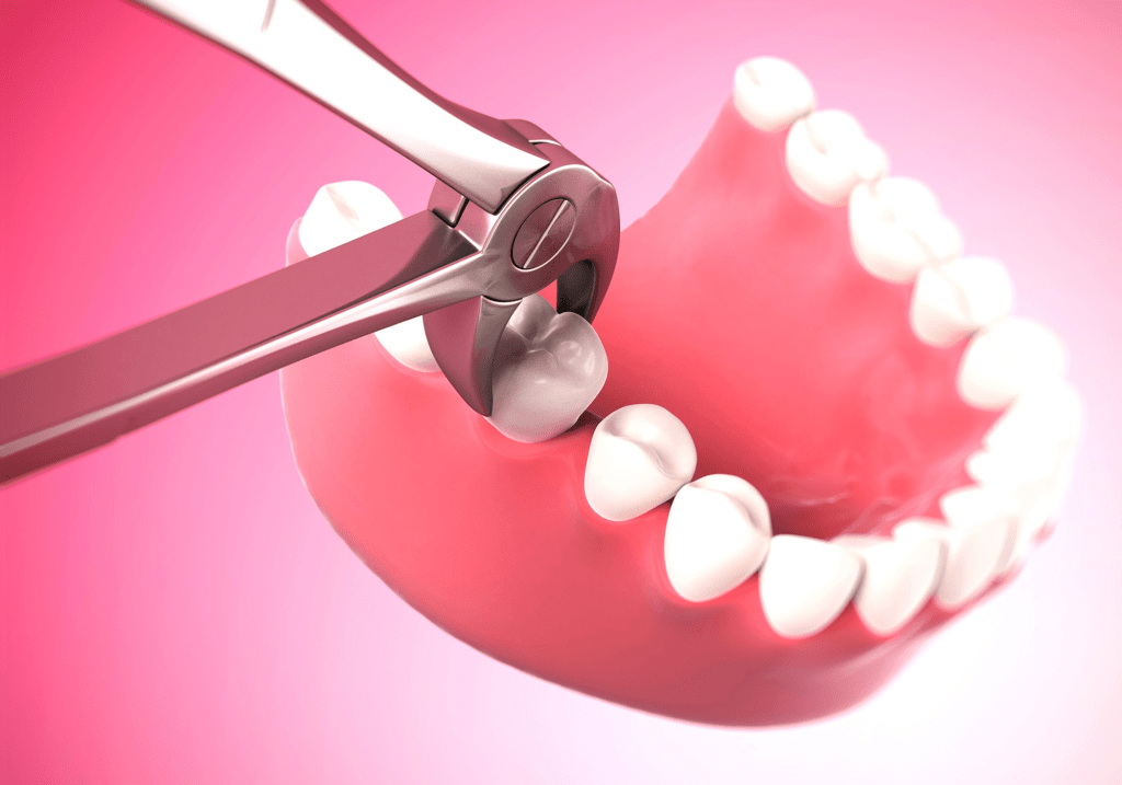 Показания к удалению зуба