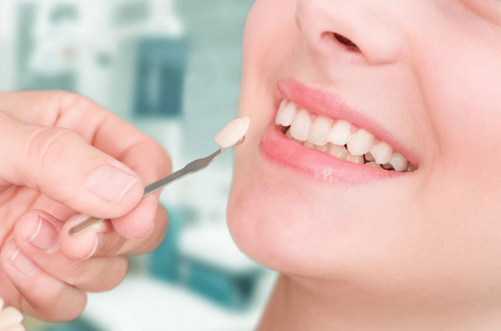 Реставрация зубов в Доступной Стоматологии