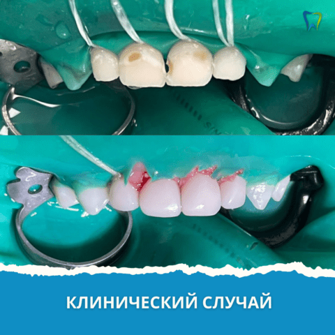 Доступная Стоматология. Лечение зубов и десен в Новосибирске