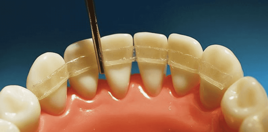 Ортодонтические методы лечения