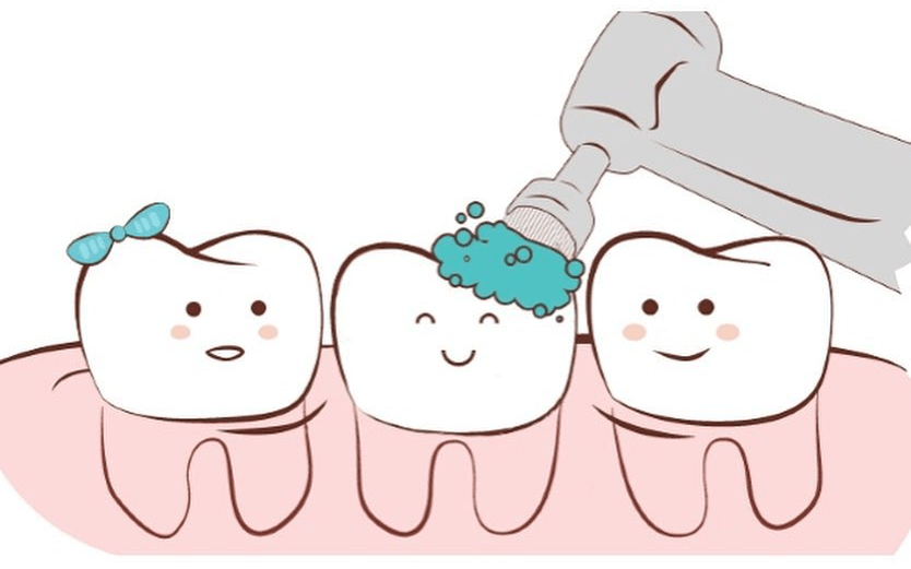 Основные этапы профессиональной чистки зубов
