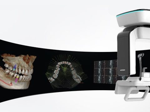Лечение КТ челюсти (Компьютерная томография зубов)